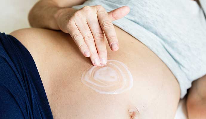 Durante el embarazo evita estrías 